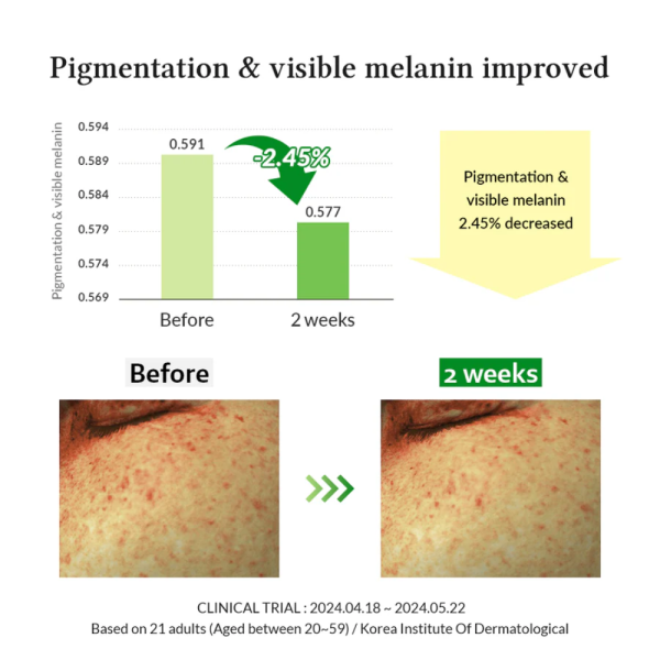 Gentle Vitamin C Serum, 30ml - Dr. Althea - Image 9